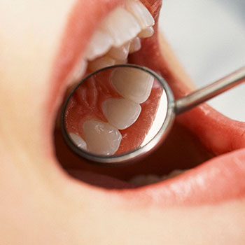 نسخه های رایج در دندانپزشکی